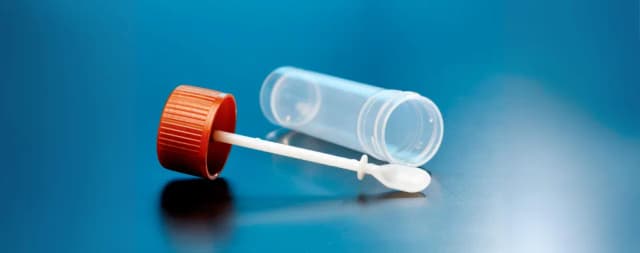 Jak pobrać kał na lamblie – uniknij najczęstszych błędów w badaniach Jak pobrać kał na lamblie – uniknij najczęstszych błędów w badaniach